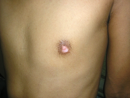 Dr Pandya Clinic Udaipur